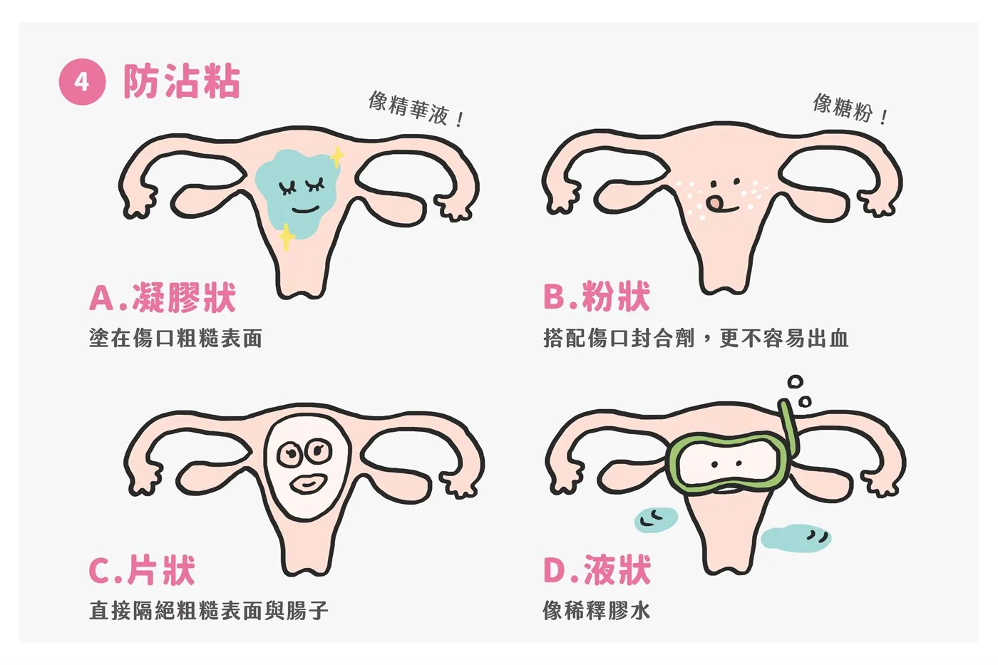 微創手術常用自費耗材　圖解第 5 張