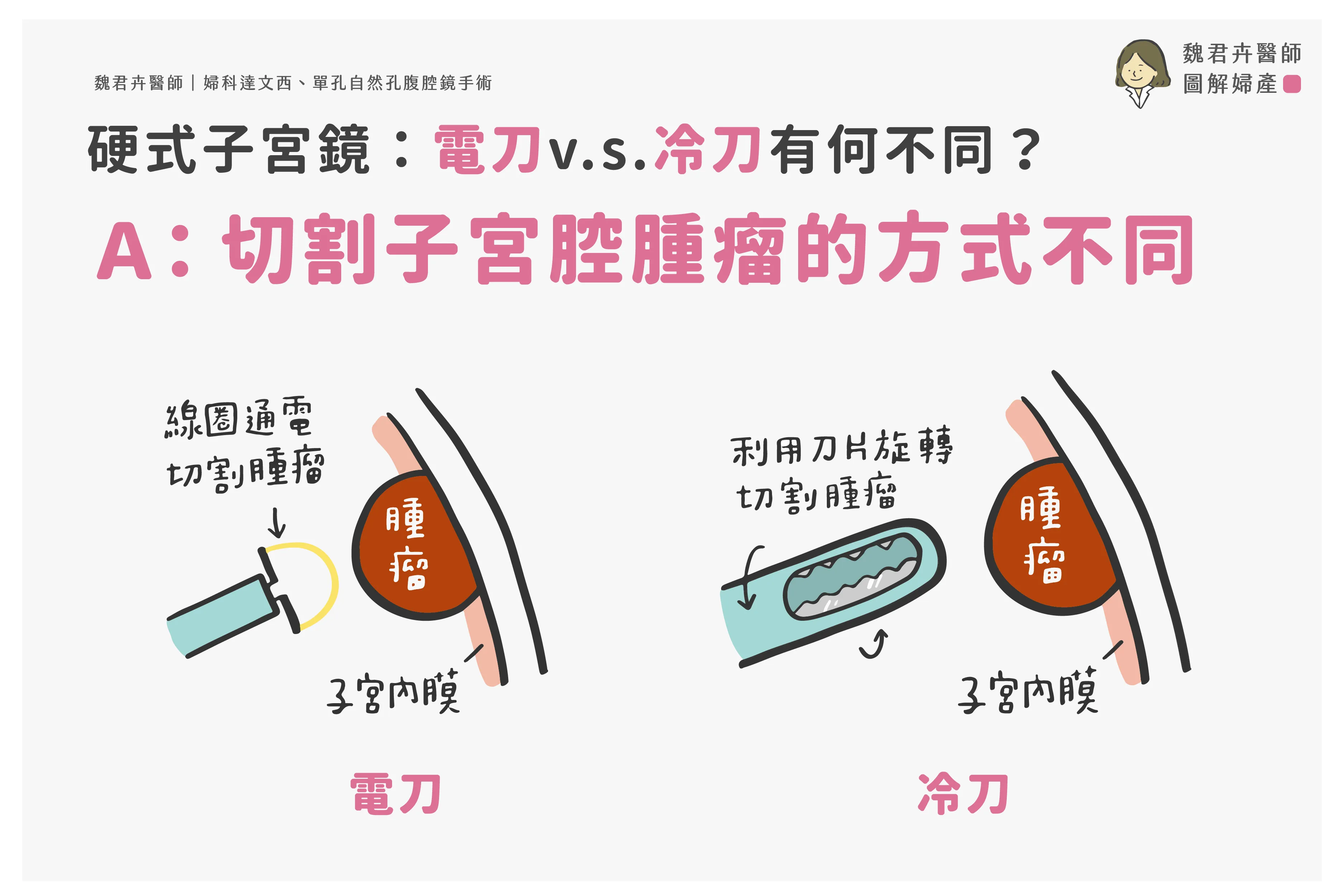 魏醫師的圖解：電刀用線圈通電切割腫瘤，冷刀用刀片旋轉切割腫瘤